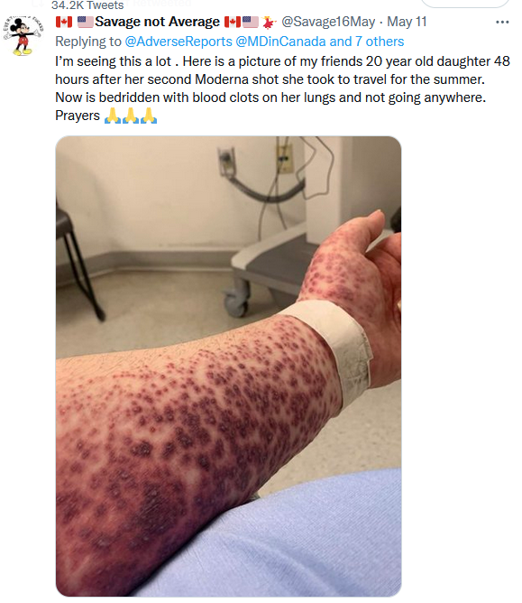 VAXX%20VIXZ%20(1).PNG