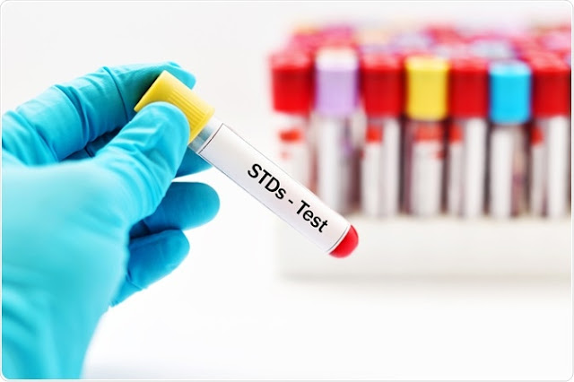 Test STD Online, First, Easy and 10% Discount with Coupon Codes also
