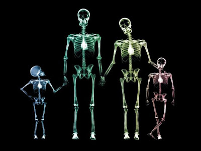 人肉X光機 - 人肉X光機可透視人體