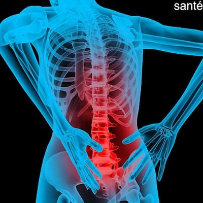 Lombalgie : causes, symptômes et méthodes de traitement