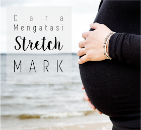 stretch mark, cara menghilangkan stretch mark, penyebab stretch mark, menghilangkan stretch mark