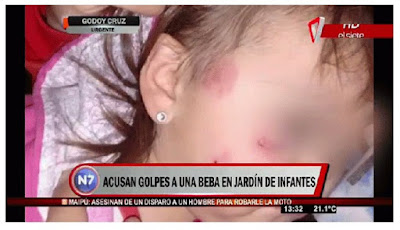 Investigan a un jardín por graves golpes y lesiones a una bebé