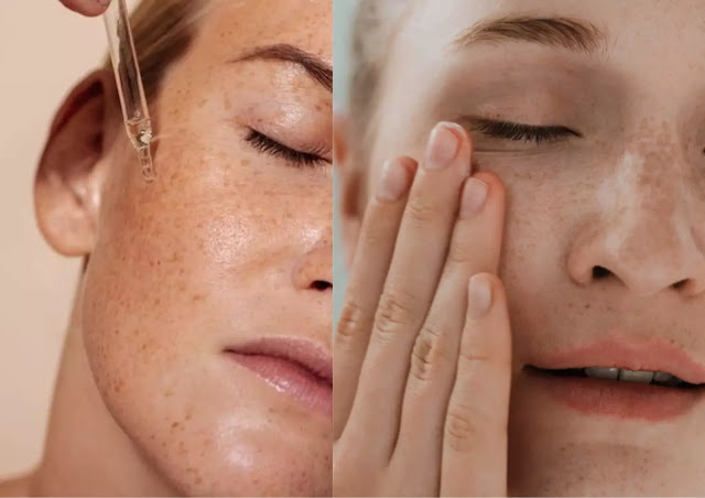 The Top 10 Ways to Get a Beautiful Face Naturally