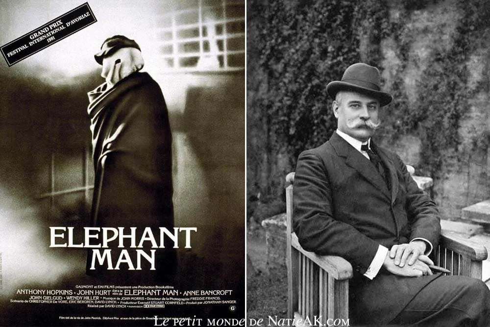Pourquoi le film Elephant Man est en noir et blanc ?