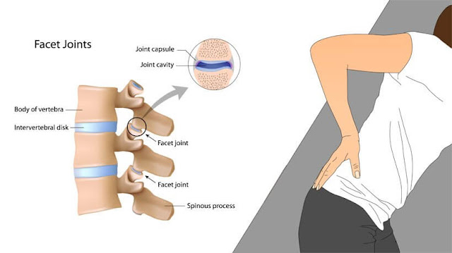 lower back pain remedies at home 