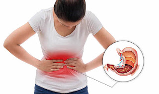 Triệu chứng loét dạ dày tá tràng là gì?
