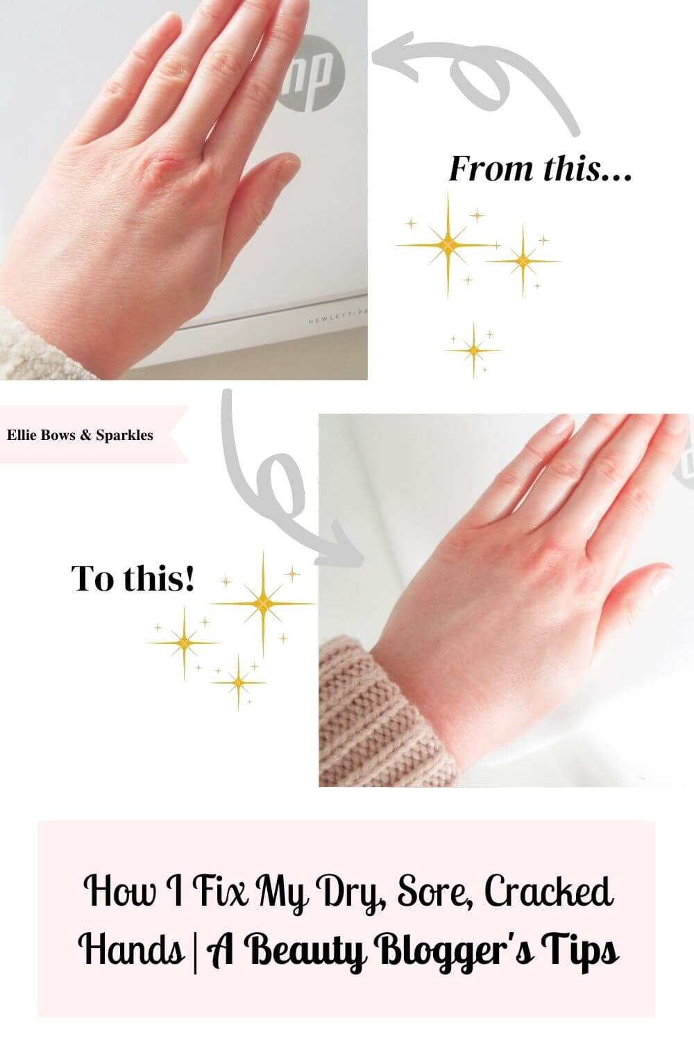 Pinterest pin with two comparison pictures of my dry, sore, cracked hand and healed hand. Grey arrows, with gold sparkles, indicate the dry hand transformation. There's a pink title card with bold, black title text, reading "How I Fix My Dry, Sore, Cracked Hands | A Beauty Blogger's Tips".