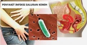 Obat Manjur kencing terasa panas di apotik