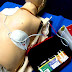 Automated external defibrillator