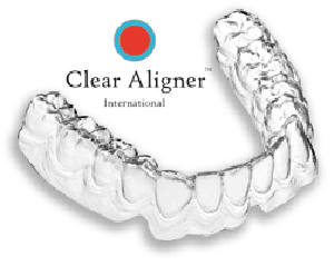Địa chỉ niềng răng không mắc cài 3D Clear Aligner