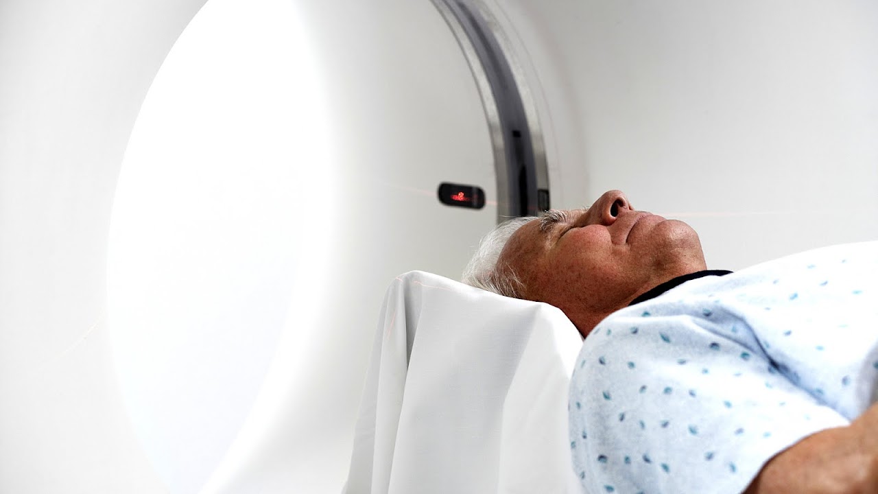 Traumatic Brain Injury Concussion