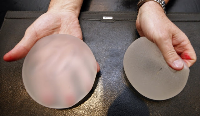 Asia Pacific Breast Implants Market