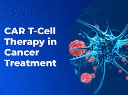 CAR T-Cell Therapy in Cancer Treatment