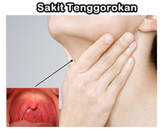 Cara Alami Mengobati Sakit Tenggorokan