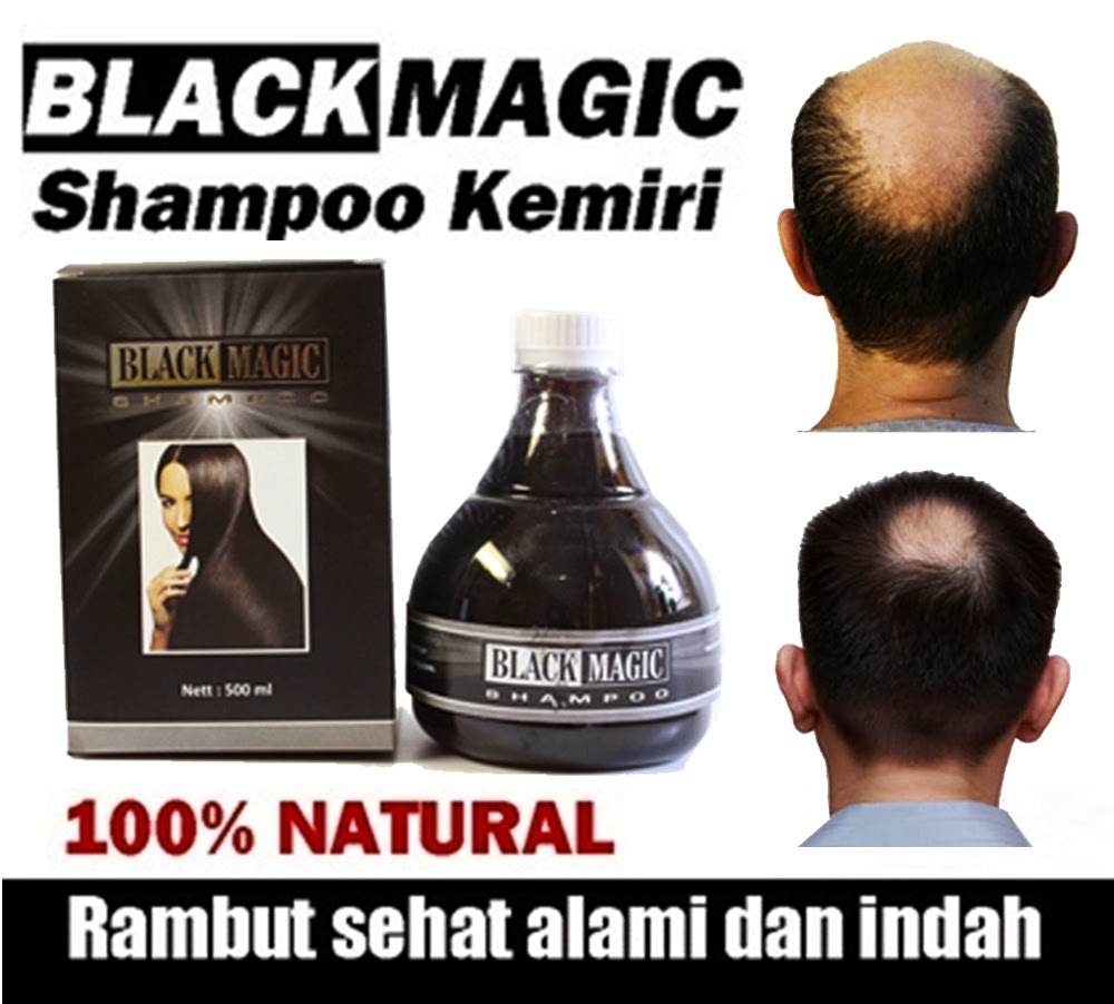 Black Magic Kemiri Shampoo Atasi Masalah Rambut Rontok
