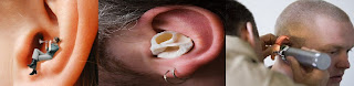 Top Natural Remedies : Homeopathic Answer For Tinnitus