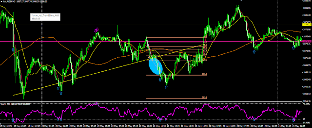 XAU/USD