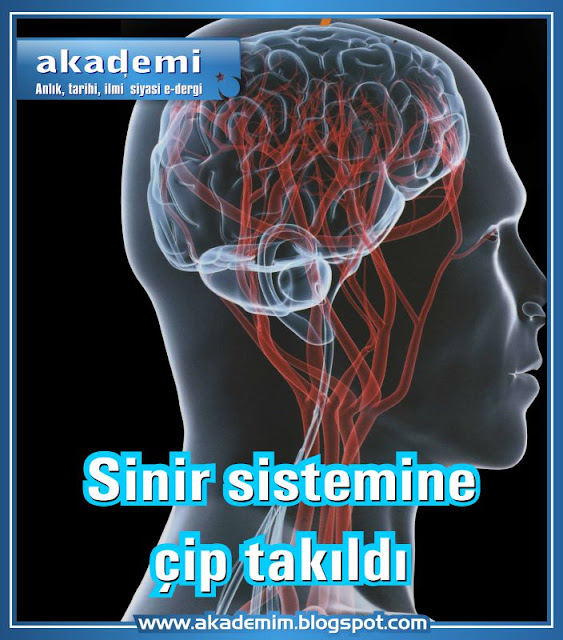 Sinir sistemine çip takıldı