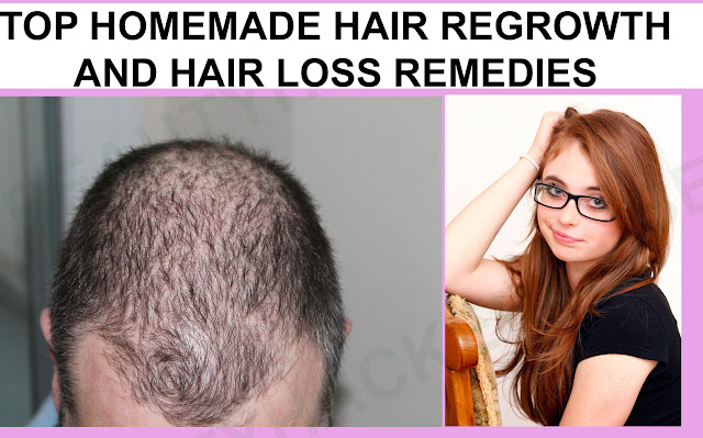 men and women hair loss and hair regrowth