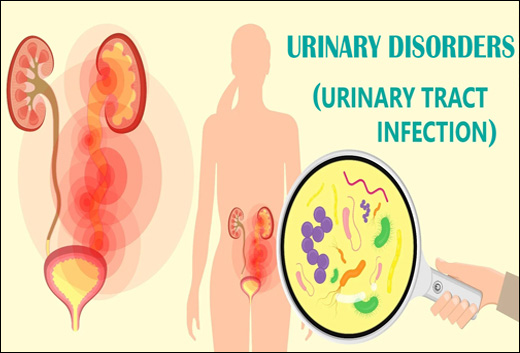 Urinary Disorders, Urinary Disease, UTI, Urinary Tract Infection, Symptoms, causes, Treatment, Ayurvedic Treatment, Ayurvedic Herbs, Herbal Products, Herbal Remedy