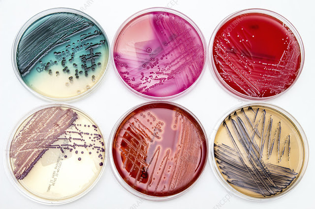Different bacterial culture media