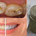 The Homemade Toothpaste That Whitens Teeth And Heals Cavities And Gum Disease