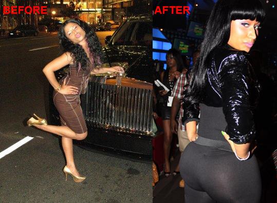 nicki minaj booty before and after plastic surgery. Nicki Minaj Booty Before and