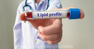 Regulation Of Lipid Metabolism