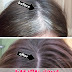 Home remedy to get rid of white hair