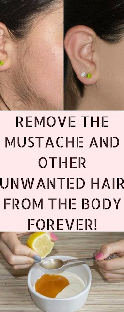 REMOVE THE MUSTACHE AND OTHER UNWANTED HAIR FROM THE BODY FOREVER!