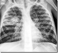 connerx-ray