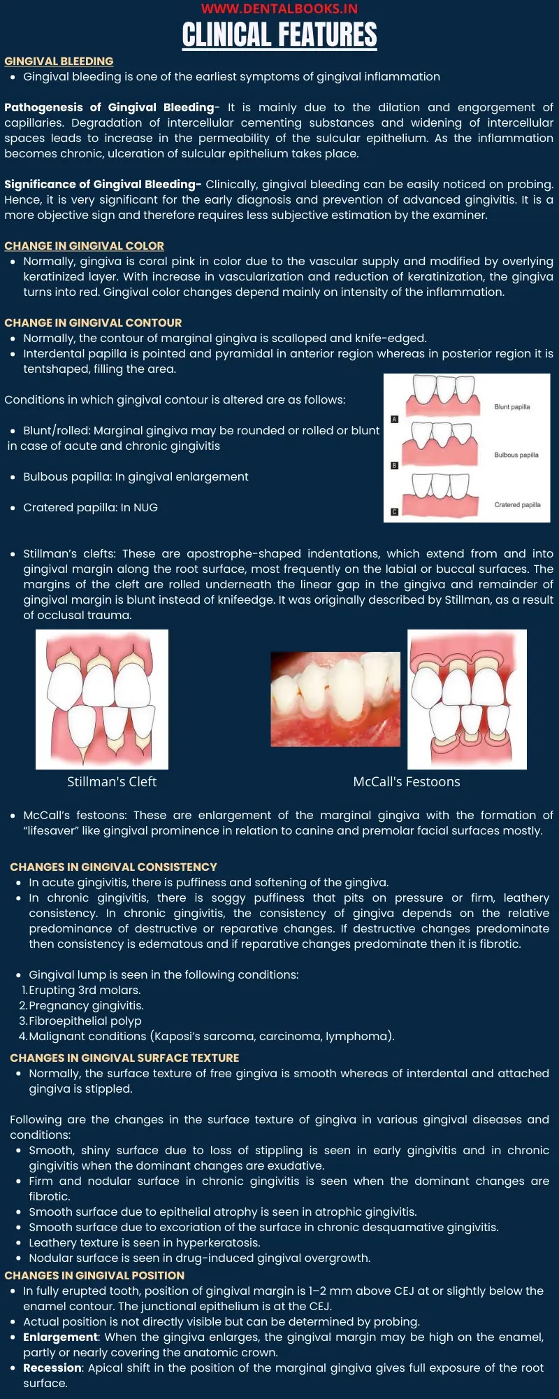 Gingivitis- Introduction, Classification, Stages and Clinical Features | Periodontics Lectures | Dental Notes
