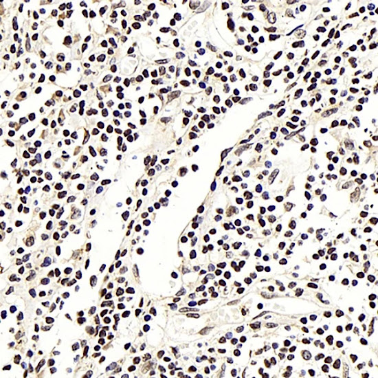 Immunohistochemistry (IHC)