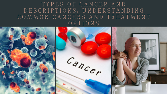 cancer types, breast cancer, lung cancer, prostate cancer, colorectal cancer, skin cancer, leukemia, lymphoma