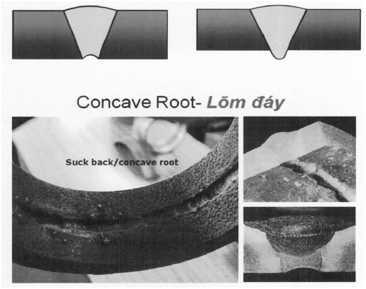Concave root defects