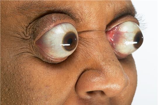 eyes-out