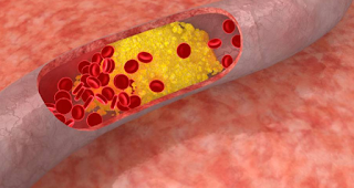 Cholesterol