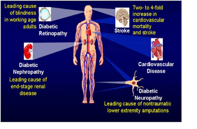 Daily Diet Plan For Type 2 Diabetes : Six Ways To Properly Manage Diabetes