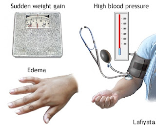 Hypertension in pregnancy