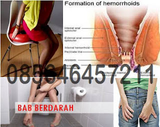 Harga Obat Ambeien AmbeJOSS Plus Zaitop