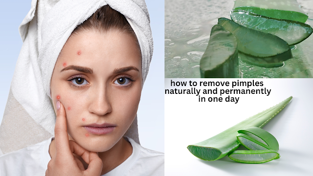 how to remove pimples naturally and permanently in one day