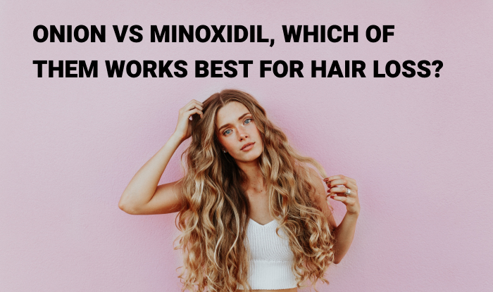 Onion Vs Minoxidil, Which of Them Works Best For Hair Loss?