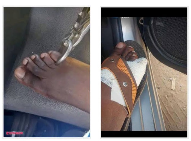 Are Zimbabweans Really Selling Their Toes