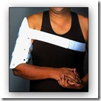 (28)Humeral Fracture Brace