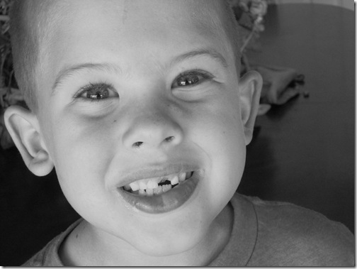 wen-tooth
