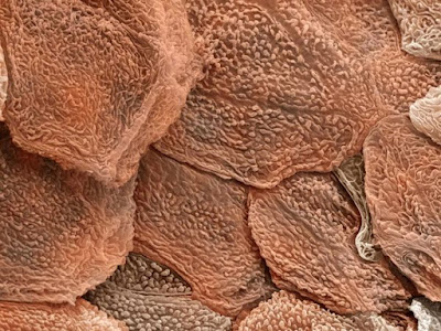 human skin cells