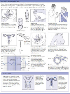 Method of contraception