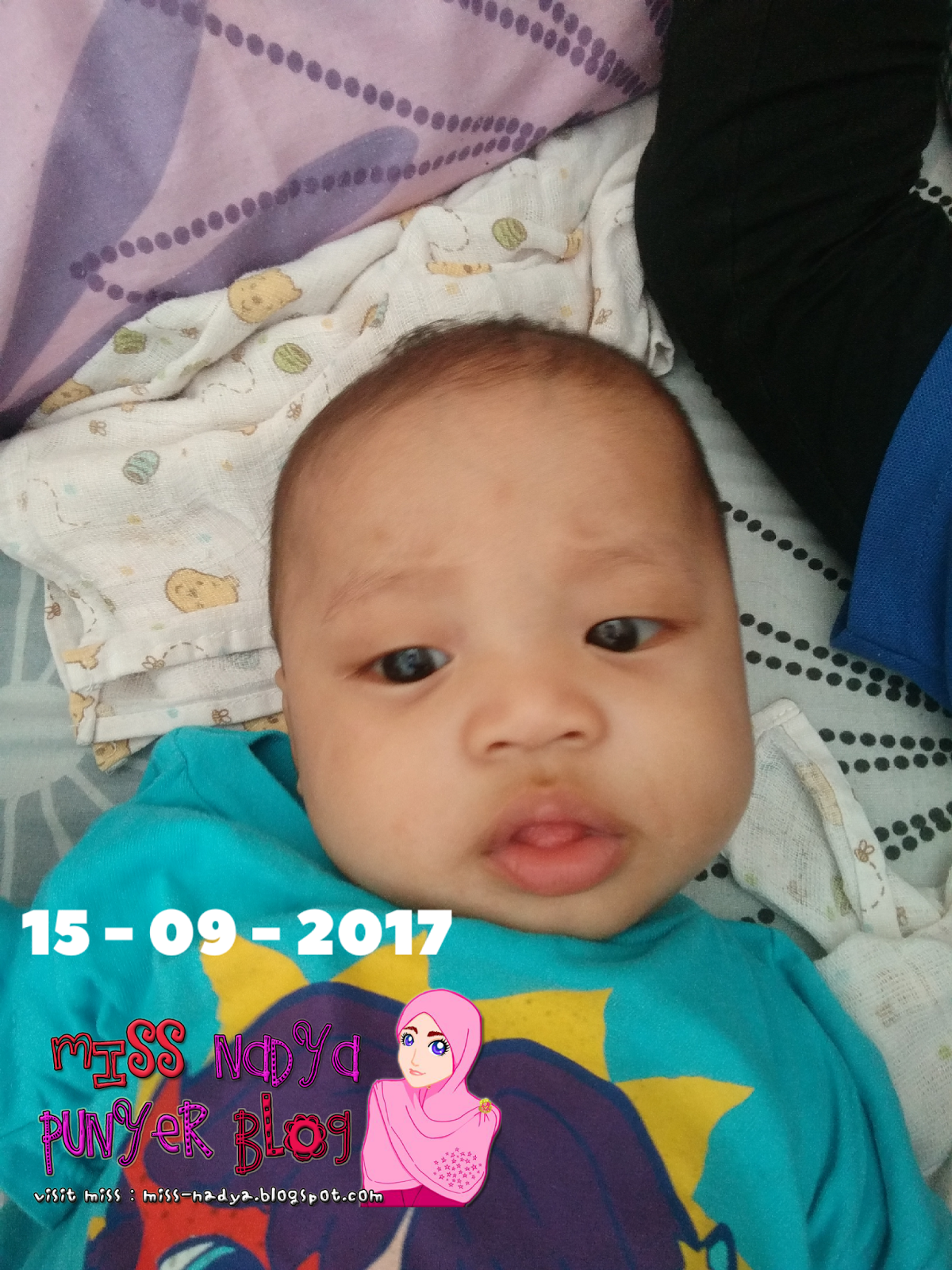 Miss Nadya [Personal Blog]: Kerak di Kepala Bayi Teruk