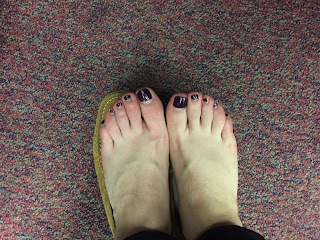 photo of feet with erythromelalgia in toes