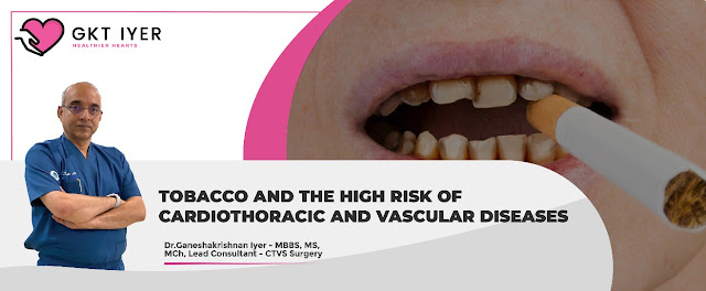 TOBACCO AND THE HIGH RISK OF CARDIOTHORACIC AND VASCULAR DISEASES